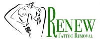 Renew Tattoo Removal LLC in Easton