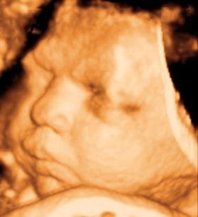 Clear Image 4D Ultrasound in Queens in Elmhurst