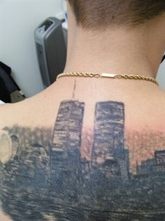 Brooklyn Laser Tattoo Removal Inc in Brooklyn