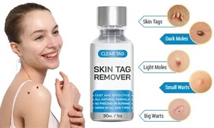 Clear Tag Skin Tag Remover Reviews in Dothan