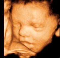 Clear Image 4D Ultrasound in Brooklyn