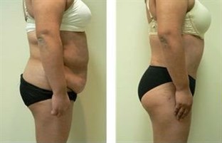 Elev8te Aesthetics & Integrative Medicin in San Antonio