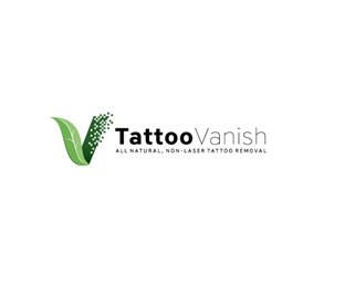 Tattoo Vanish in Hialeah